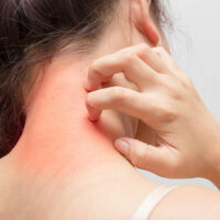 Causes and treatments for common skin allergies
