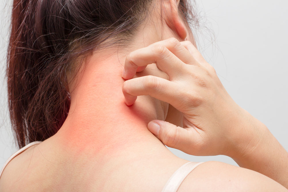 Causes and treatments for common skin allergies