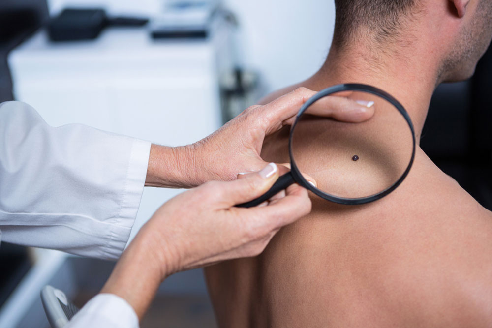Causes and risk factors of skin cancer