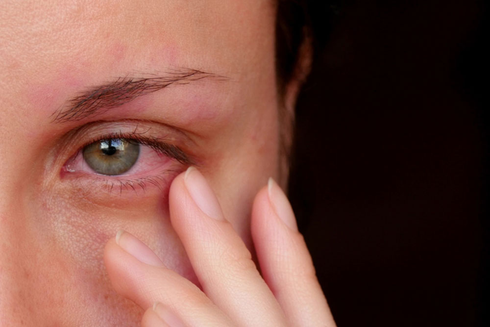 Eye infection – Common types and precautions