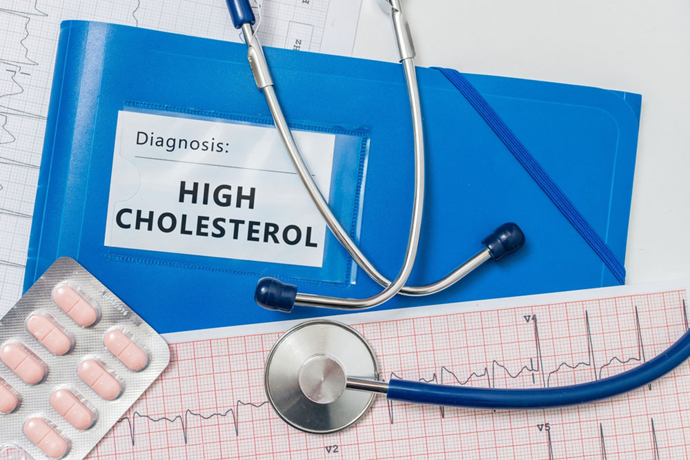 How high cholesterol can affect health