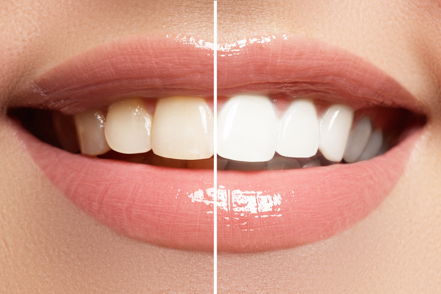 Natural Ways to Whiten Teeth at Home